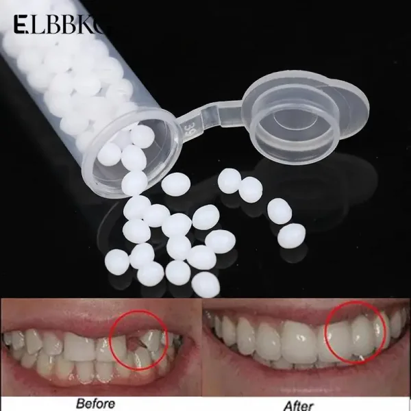 Kit de reparaci n temporal de dientes herramienta de belleza para blanqueamiento dental pegamento s lido